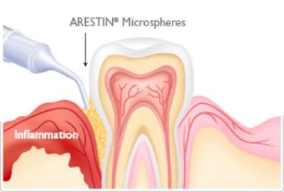 Gum health