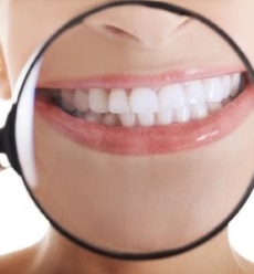 Teeth Whitening