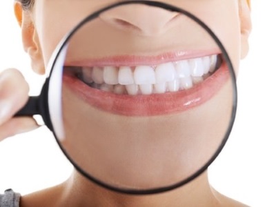 Zoom teeth whitening
